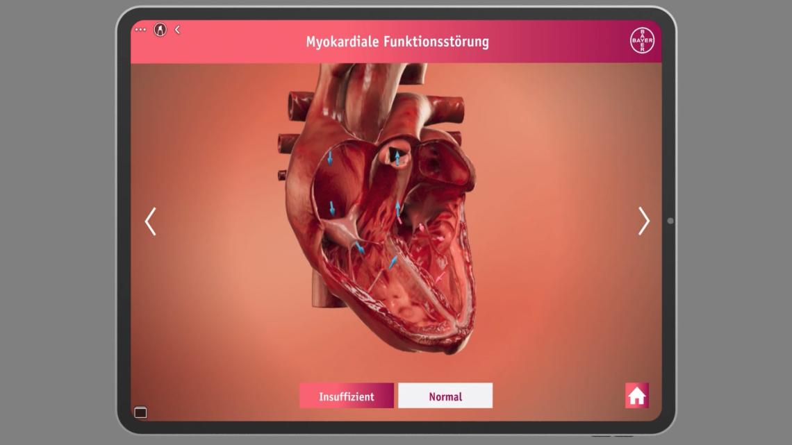 Heart